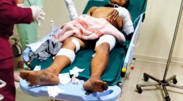 Lima Pekerja Wifi Tersambar Listrik di Purwokerto, Dugaan Kelalaian Kerja Menguat: Potensi Pidana Mengintai Perusahaan